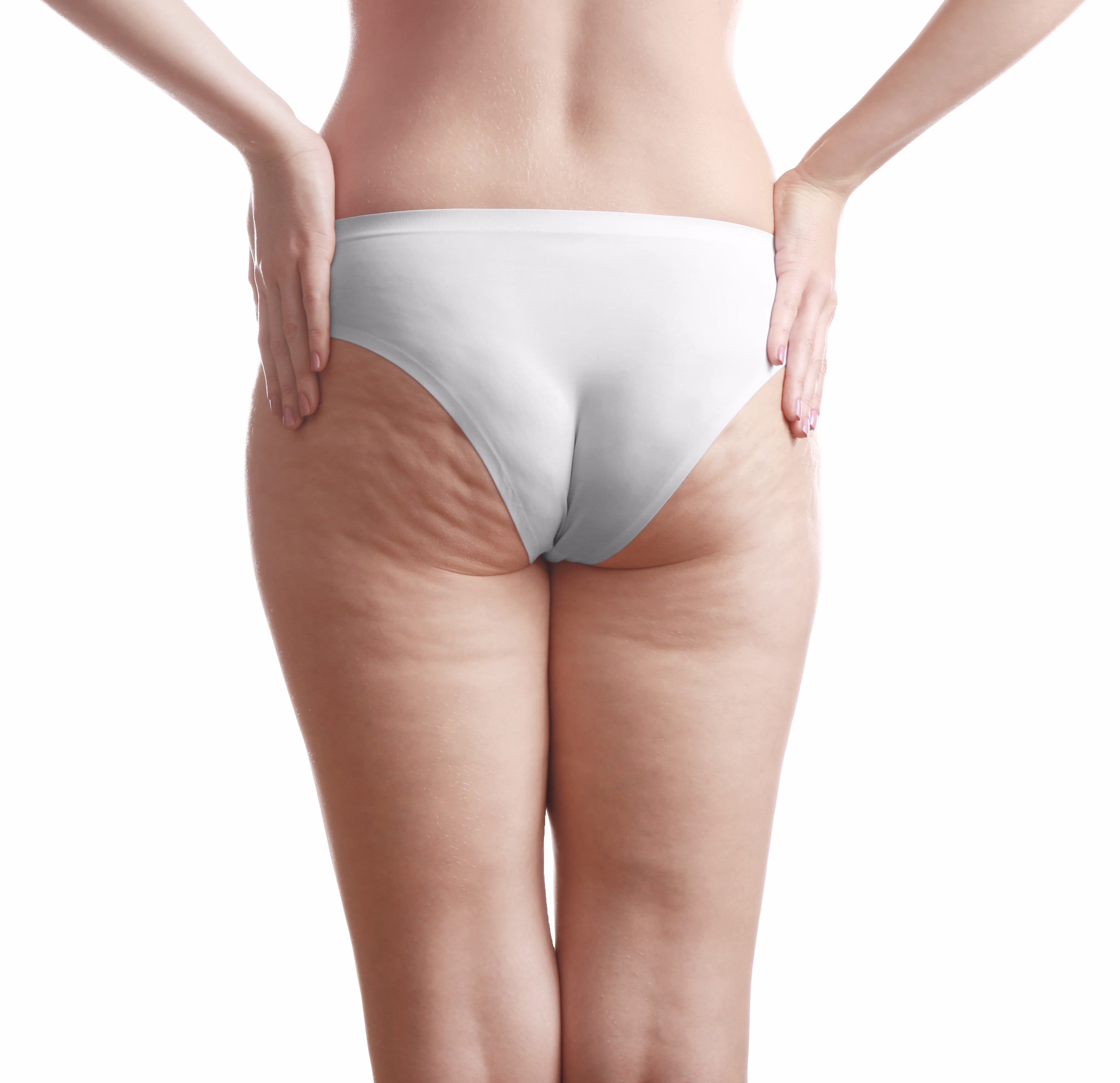 Tratamento para Celulite