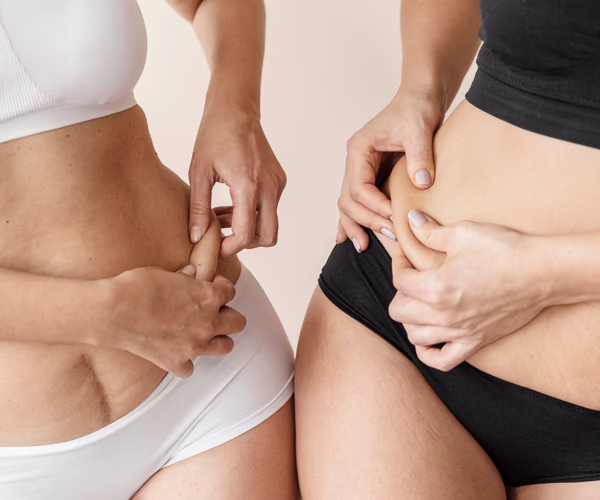 Representação visual de gordura localizada na região abdominal.