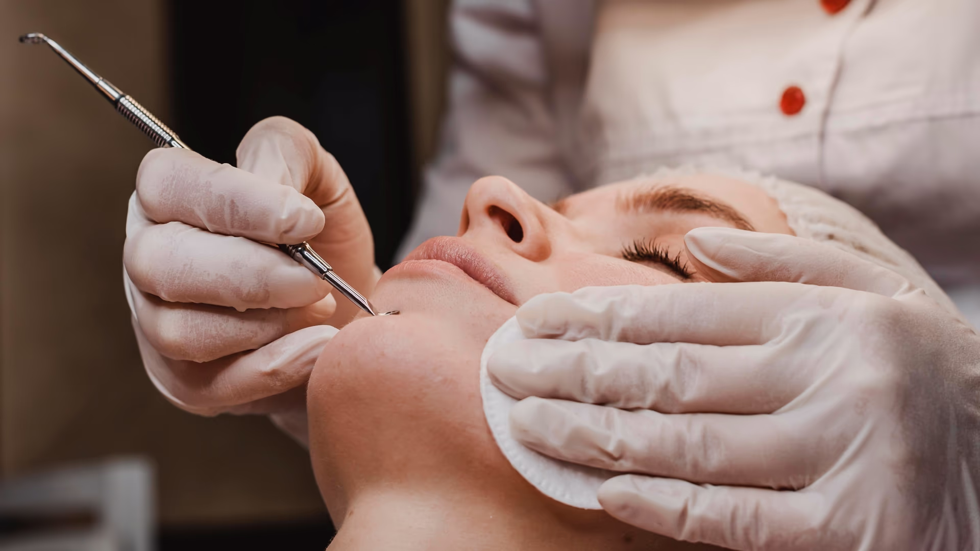 Profissional com luvas realizando extração durante limpeza de pele facial