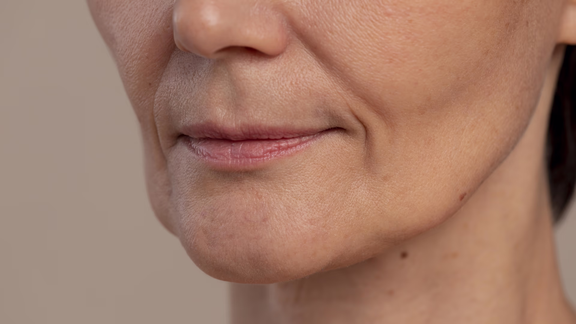 Close da região inferior do rosto feminino com linhas e flacidez leve, ilustrando mudanças faciais após emagrecimento