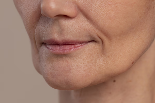 Close da região inferior do rosto feminino com linhas e flacidez leve, ilustrando mudanças faciais após emagrecimento