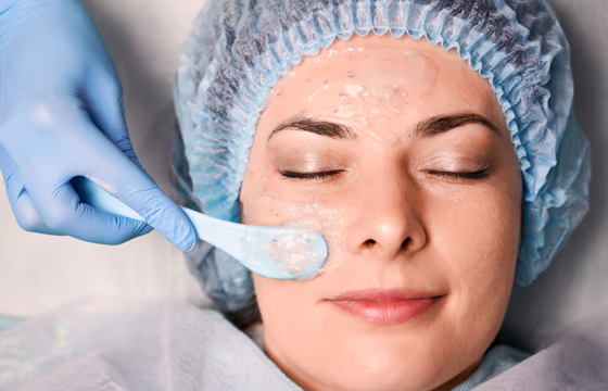Profissional aplicando produto de peeling químico no rosto de cliente deitada