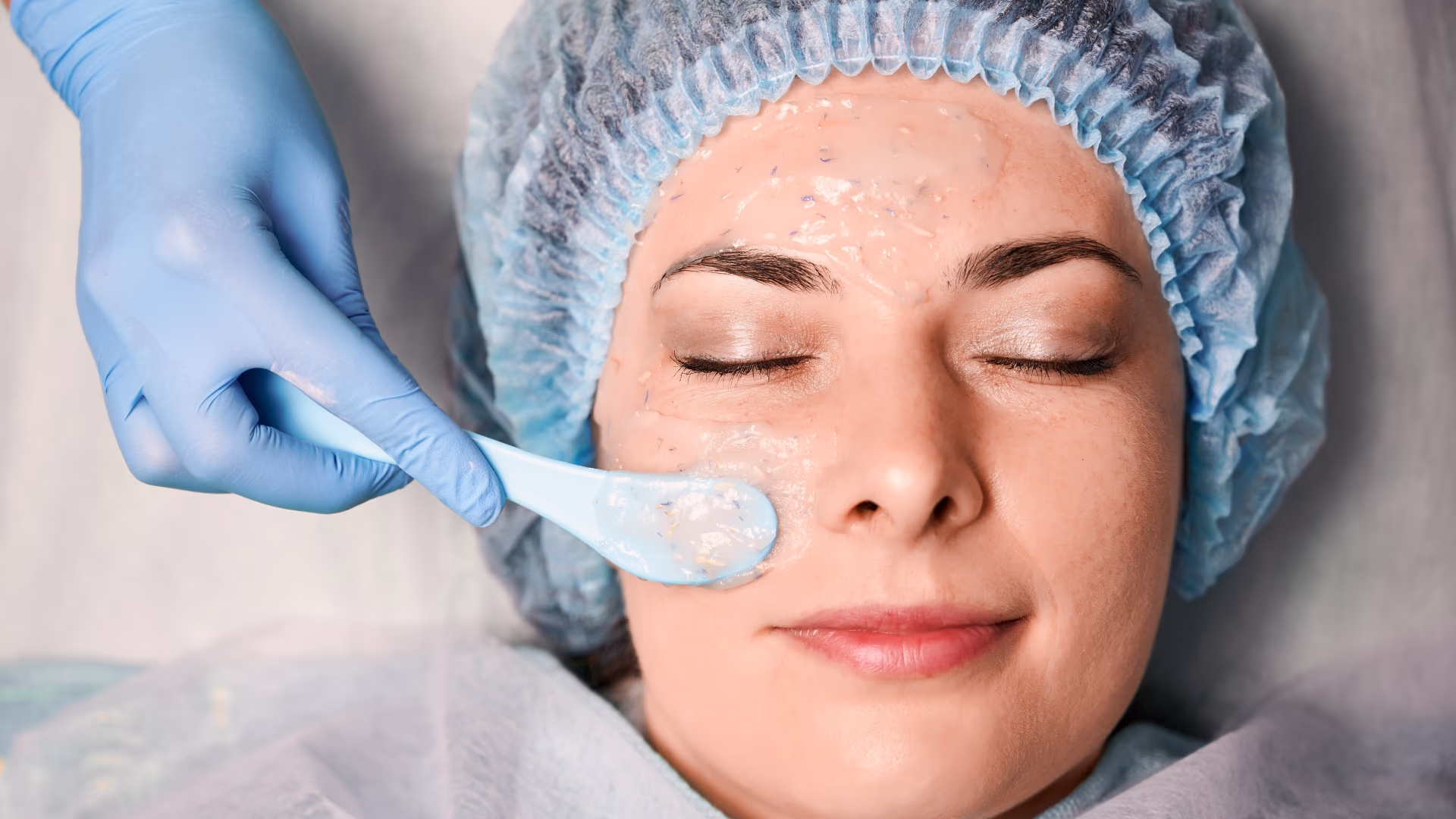 Profissional aplicando produto de peeling químico no rosto de cliente deitada