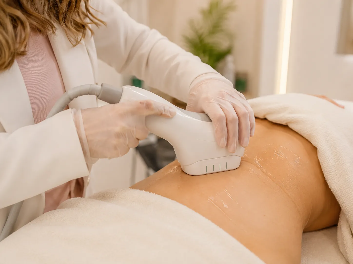 Aplicação corporal de ultrassom macrofocado Aplicação de ultrassom macrofocado corporal em protocolo estético na Beauté em Palhoça