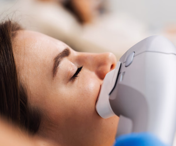 Ultrassom microfocado sendo aplicado no rosto em Palhoça por profissional da Beauté para estímulo de colágeno, efeito lifting facial e rejuvenescimento da pele